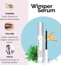 3-Delige Elektrische Wimperkruller Set – Incl. Wimperserum & Wimperborstel – Wimperlifting Set – Lash Lift – Lange, Gekrulde En Volle Wimpers – Eyelash Curler 16 3-Delige Elektrische Wimperkruller Set – Incl. Wimperserum & Wimperborstel – Wimperlifting Set – Lash Lift – Lange, Gekrulde En Volle Wimpers – Eyelash Curler -Cosmetische Kortingen Winkel 1115x1200 6
