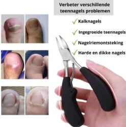 Merkloos Nageltang Voor Harde Teennagels - Manicureset Teennagelknipper - Teennagelschaar - Pedicure Set -Cosmetische Kortingen Winkel 1196x1200 38