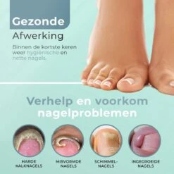 Christian Deluxe® - Professionele Nageltang Set - Nagelriemreiniger - Luxe Giftbox - Nageltang Voor Harde Teennagels - Professionele Nagelknipper - Nageltang Voor Ingegroeide Teennagel - Nageltang Kalknagels - Nagelknipper - Roestvrijstaal -Cosmetische Kortingen Winkel 1200x1200 2280