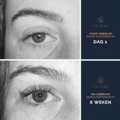 Skines® Wimperserum Premium – Eyelash Serum - Wenkbrauw Serum - Wimper Groei - 3ML -Cosmetische Kortingen Winkel 1200x1200 953