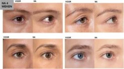 L'Oréal Paris Clinically Proven Wimperserum - 2 Ml -Cosmetische Kortingen Winkel 1200x670 2