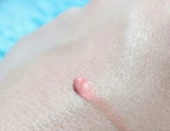 Biodermal Sun Lipbalm SPF25 - Tube 12 Ml - Natural Pink - Lippenbalsem 9 Biodermal Sun Lipbalm SPF25 - Tube 12 Ml - Natural Pink - Lippenbalsem -Cosmetische Kortingen Winkel 1200x927 3