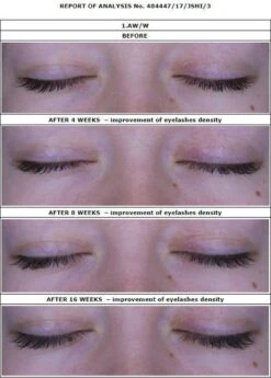 Oceanic Long4Lashes Gold Eyelash Wimpernserum 4 Ml -Cosmetische Kortingen Winkel 859x1200 1